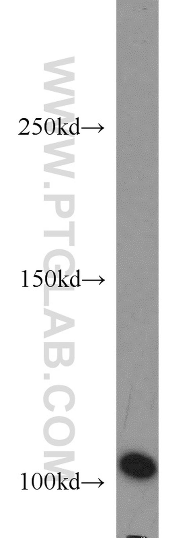 AP1B1 Antibody in Western Blot (WB)