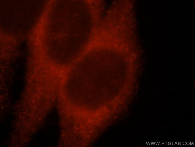 AP1B1 Antibody in Immunocytochemistry (ICC/IF)