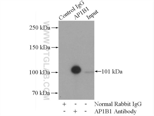 AP1B1 Antibody in Immunoprecipitation (IP)