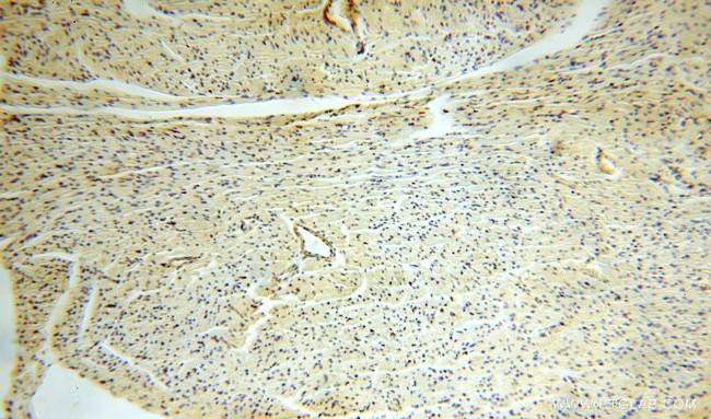 GALNT14 Antibody in Immunohistochemistry (Paraffin) (IHC (P))