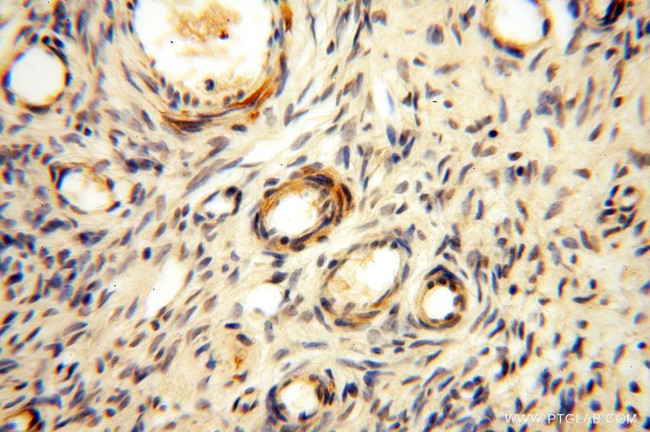 GALNT14 Antibody in Immunohistochemistry (Paraffin) (IHC (P))