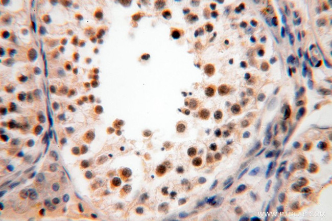 GALNT14 Antibody in Immunohistochemistry (Paraffin) (IHC (P))