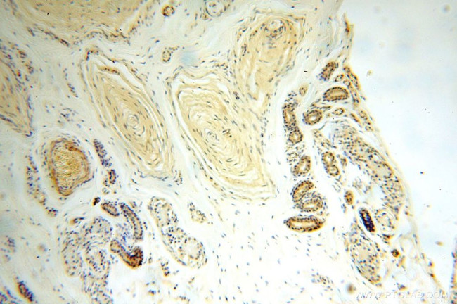 GALNT14 Antibody in Immunohistochemistry (Paraffin) (IHC (P))