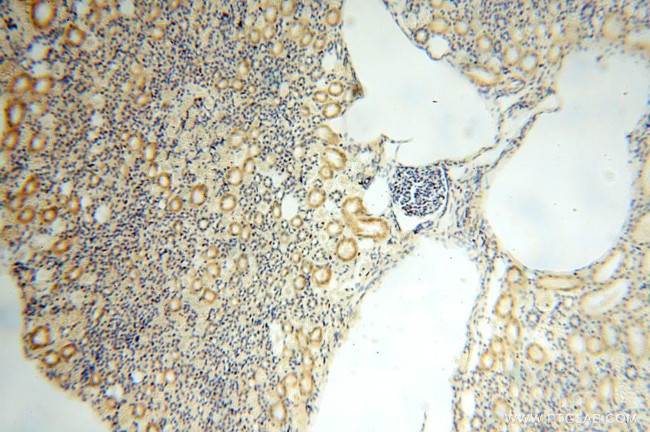 GALNT14 Antibody in Immunohistochemistry (Paraffin) (IHC (P))