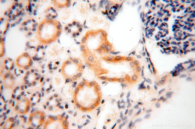 GALNT14 Antibody in Immunohistochemistry (Paraffin) (IHC (P))