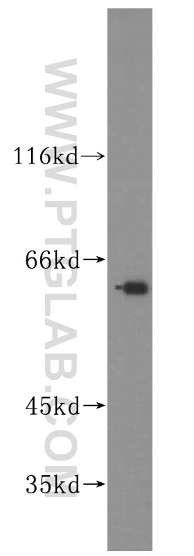 GALNT14 Antibody in Western Blot (WB)