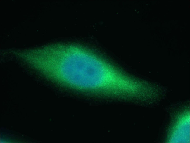 SAPS3 Antibody in Immunocytochemistry (ICC/IF)