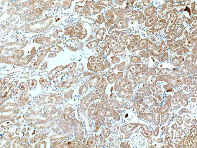 SAPS3 Antibody in Immunohistochemistry (Paraffin) (IHC (P))