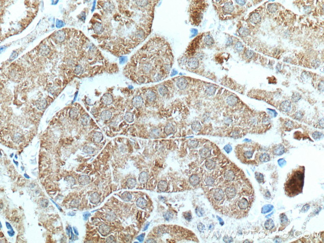 SAPS3 Antibody in Immunohistochemistry (Paraffin) (IHC (P))