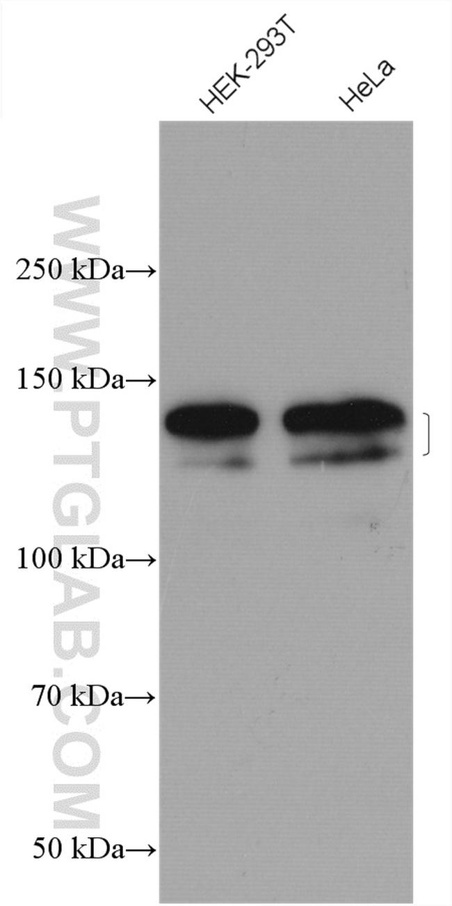 SAPS3 Antibody in Western Blot (WB)