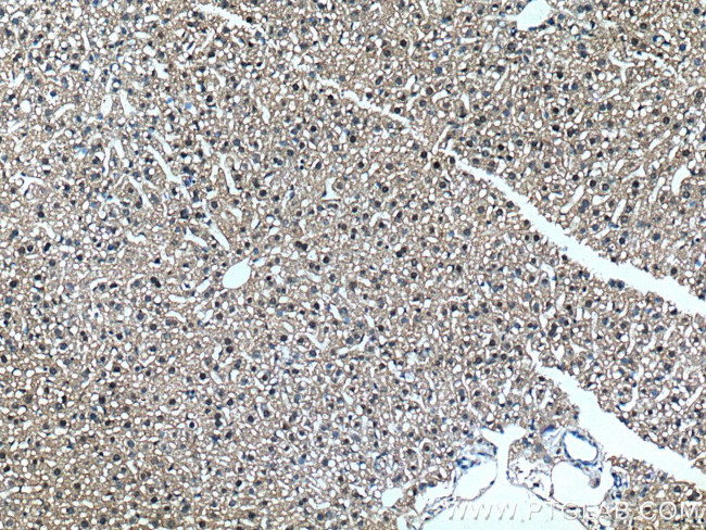 SAPS3 Antibody in Immunohistochemistry (Paraffin) (IHC (P))