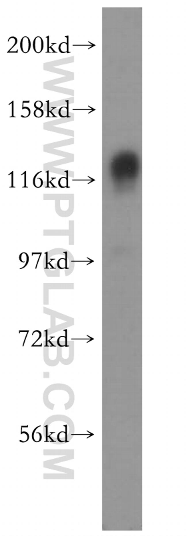 SAPS3 Antibody in Western Blot (WB)