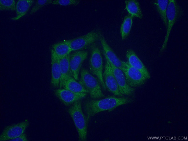 RPS21 Antibody in Immunocytochemistry (ICC/IF)