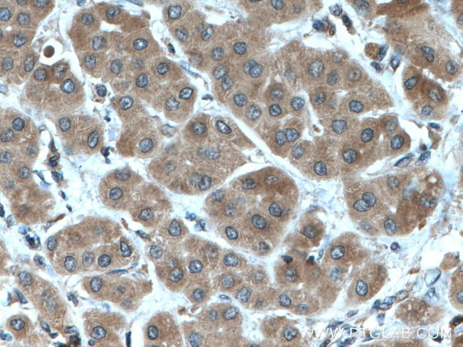 RPS21 Antibody in Immunohistochemistry (Paraffin) (IHC (P))