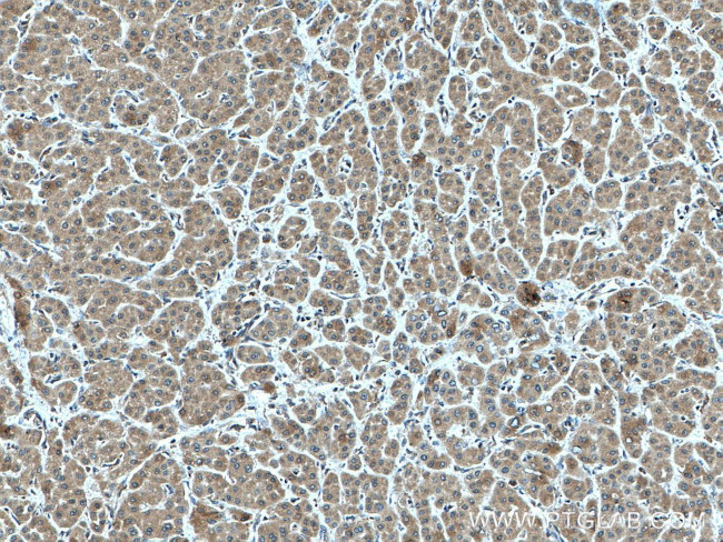 RPS21 Antibody in Immunohistochemistry (Paraffin) (IHC (P))