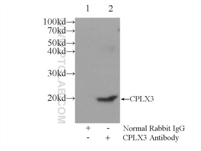 CPLX3 Antibody in Immunoprecipitation (IP)