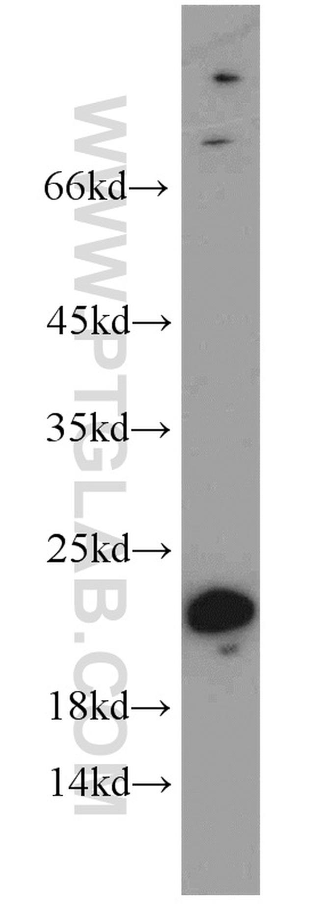 CPLX3 Antibody in Western Blot (WB)