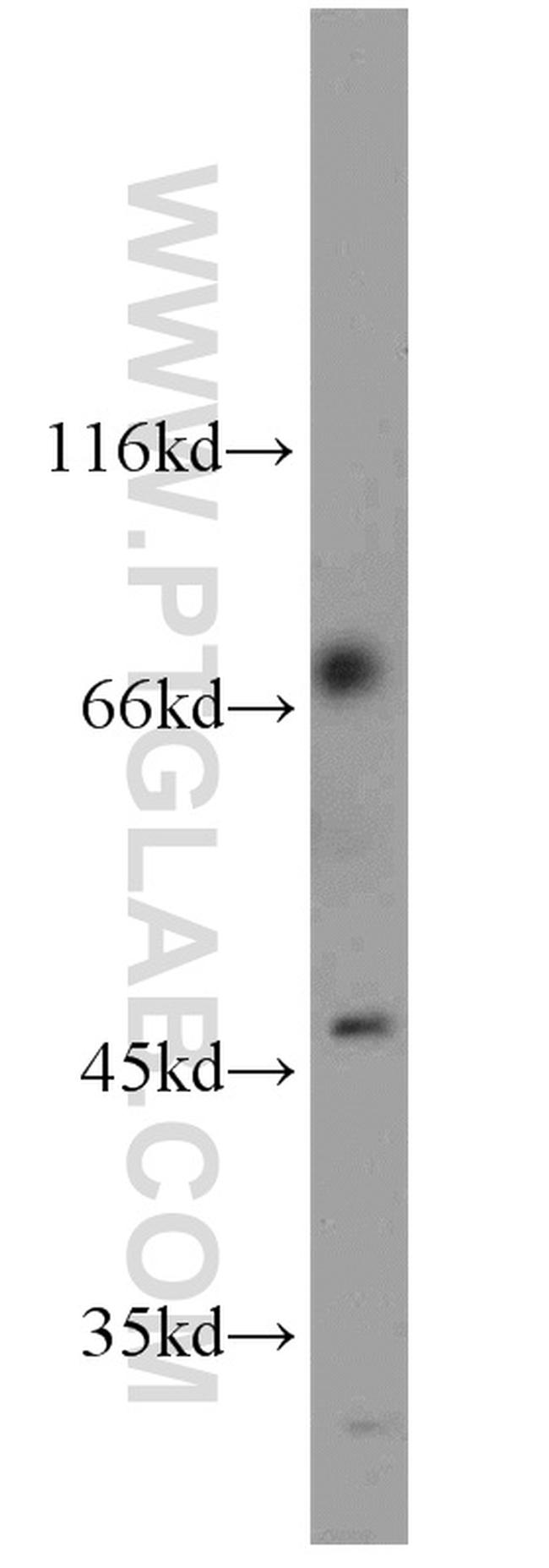 ZNF3 Antibody in Western Blot (WB)