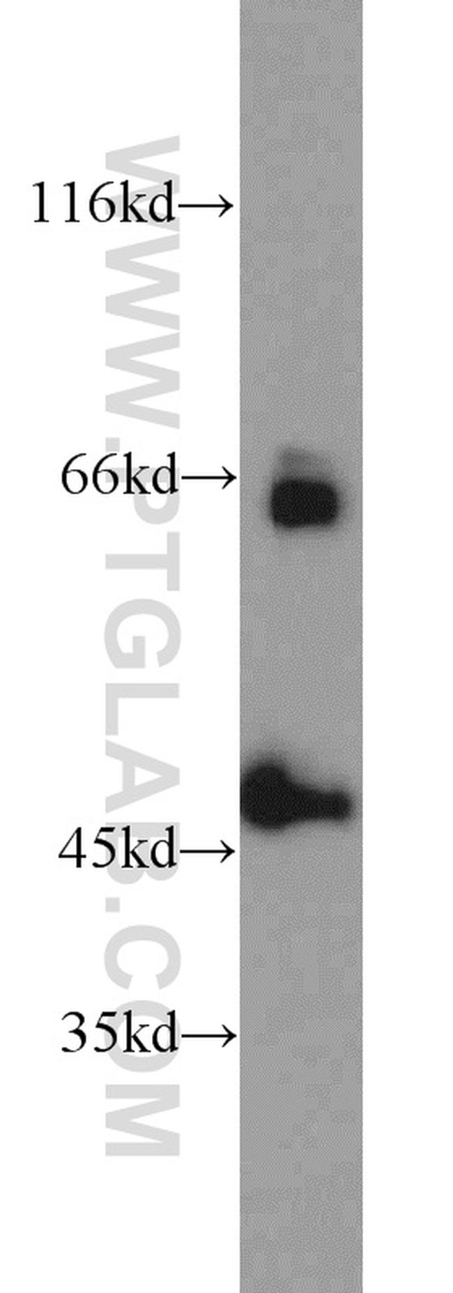 ZNF3 Antibody in Western Blot (WB)