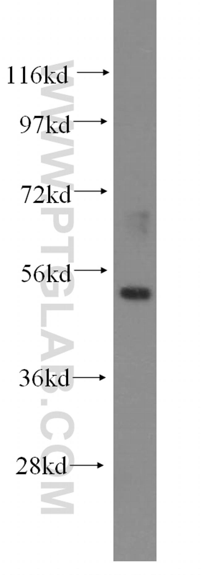 ZNF3 Antibody in Western Blot (WB)