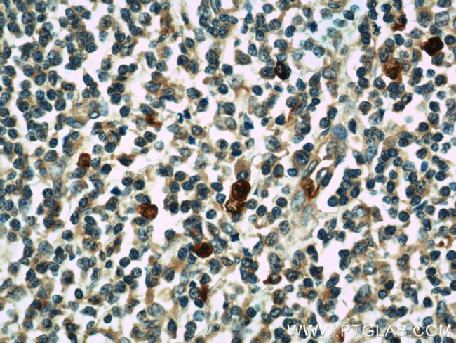 KLHL3 Antibody in Immunohistochemistry (Paraffin) (IHC (P))