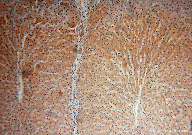 KLHL3 Antibody in Immunohistochemistry (Paraffin) (IHC (P))