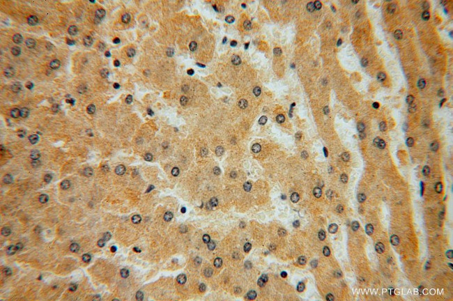 KLHL3 Antibody in Immunohistochemistry (Paraffin) (IHC (P))