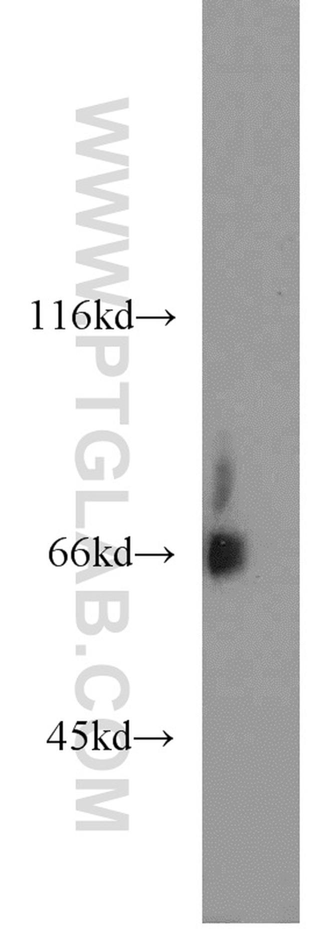 KLHL3 Antibody in Western Blot (WB)