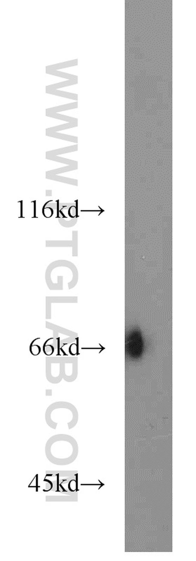 KLHL3 Antibody in Western Blot (WB)