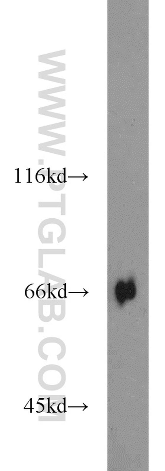 KLHL3 Antibody in Western Blot (WB)