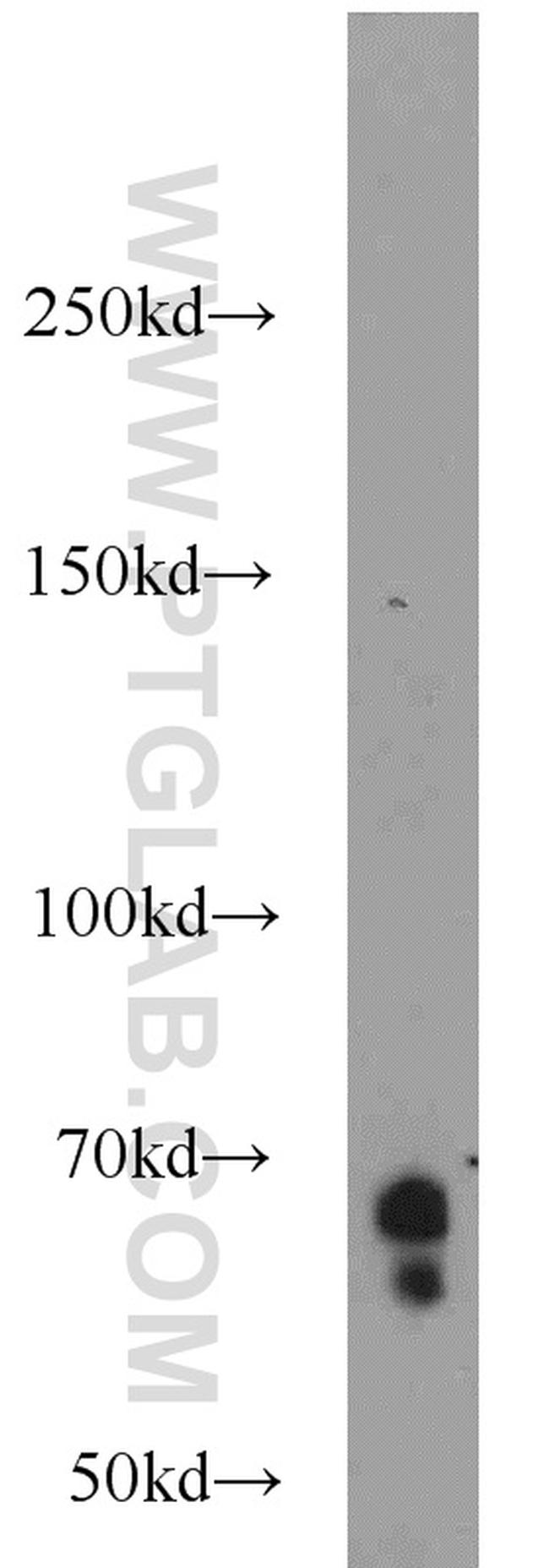 KLHL3 Antibody in Western Blot (WB)