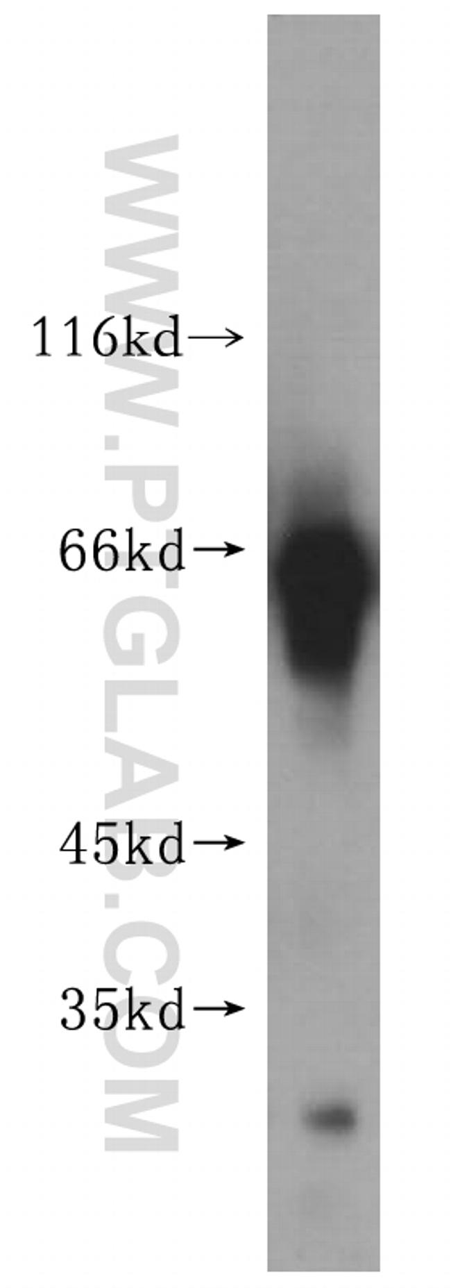 KLHL3 Antibody in Western Blot (WB)