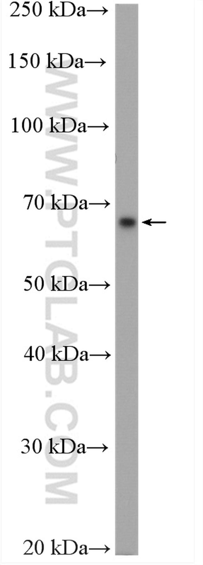 KLHL3 Antibody in Western Blot (WB)