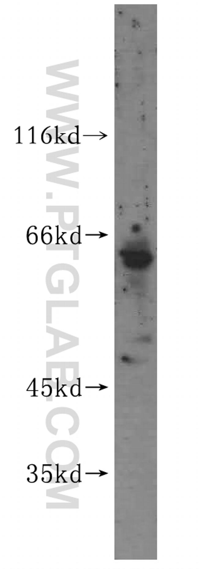MEF2C Antibody in Western Blot (WB)