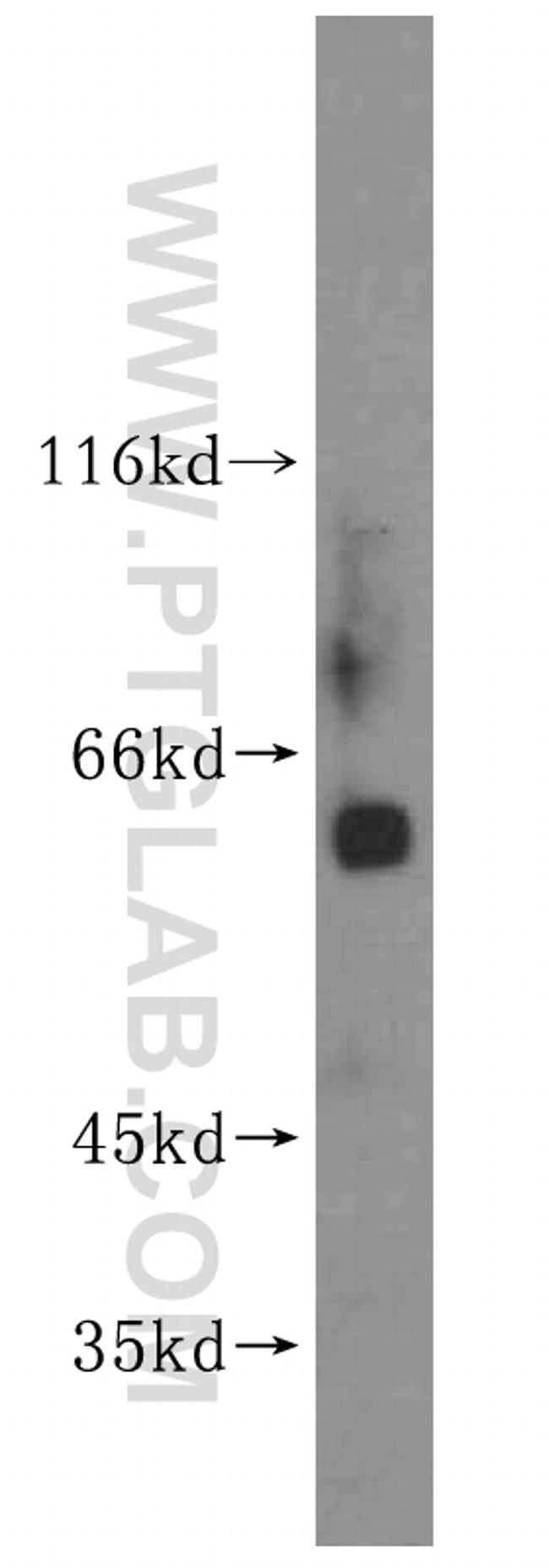 MEF2C Antibody in Western Blot (WB)