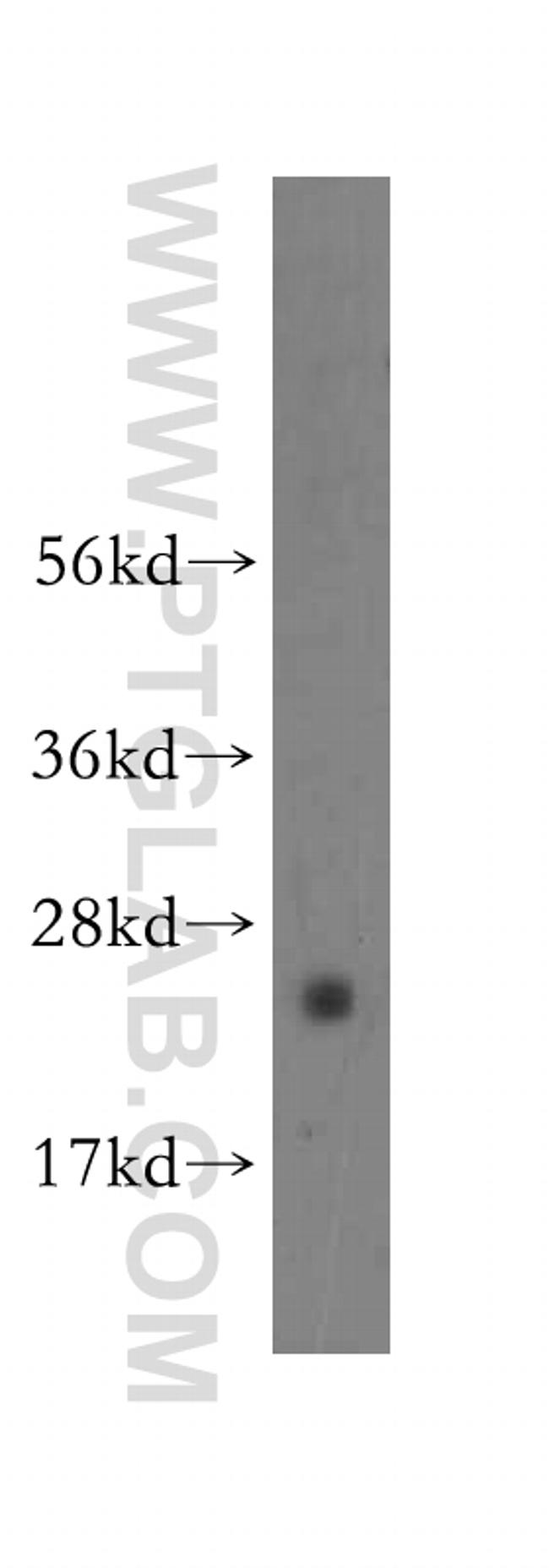 N6AMT2 Antibody in Western Blot (WB)