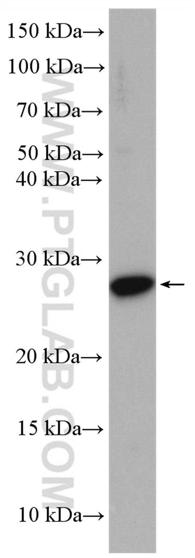 N6AMT2 Antibody in Western Blot (WB)