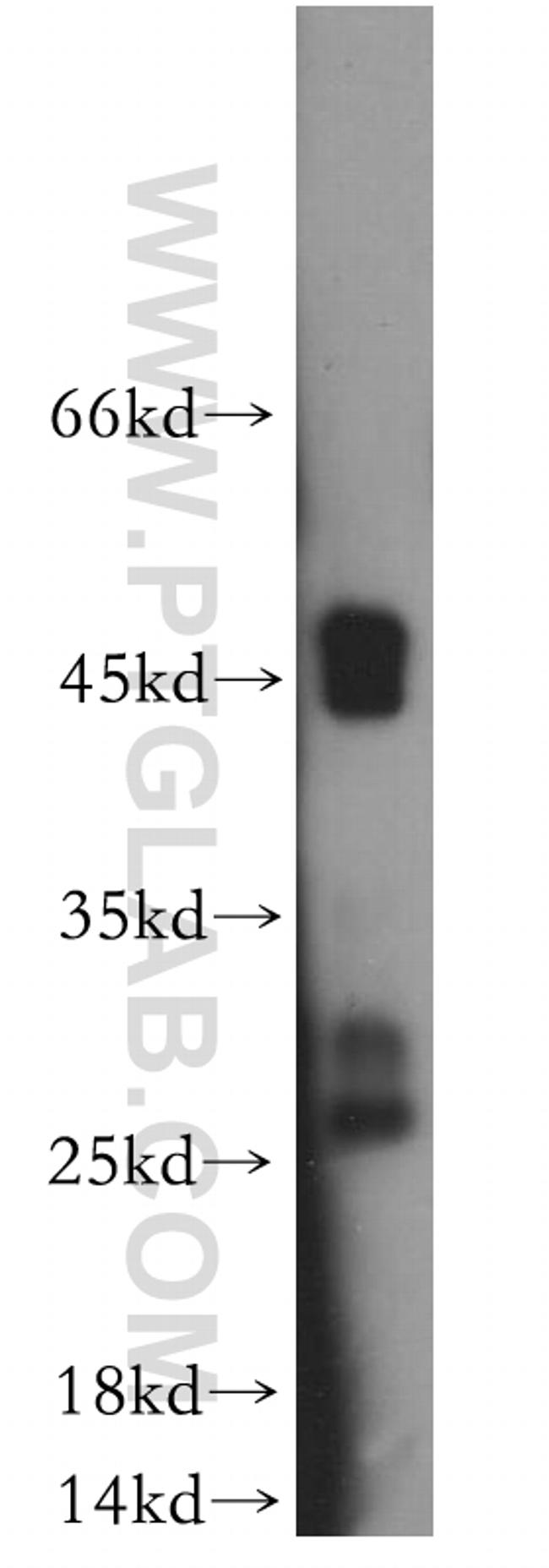 Connexin-26 Antibody in Western Blot (WB)