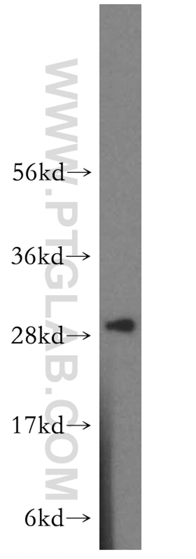 CA2 Antibody in Western Blot (WB)