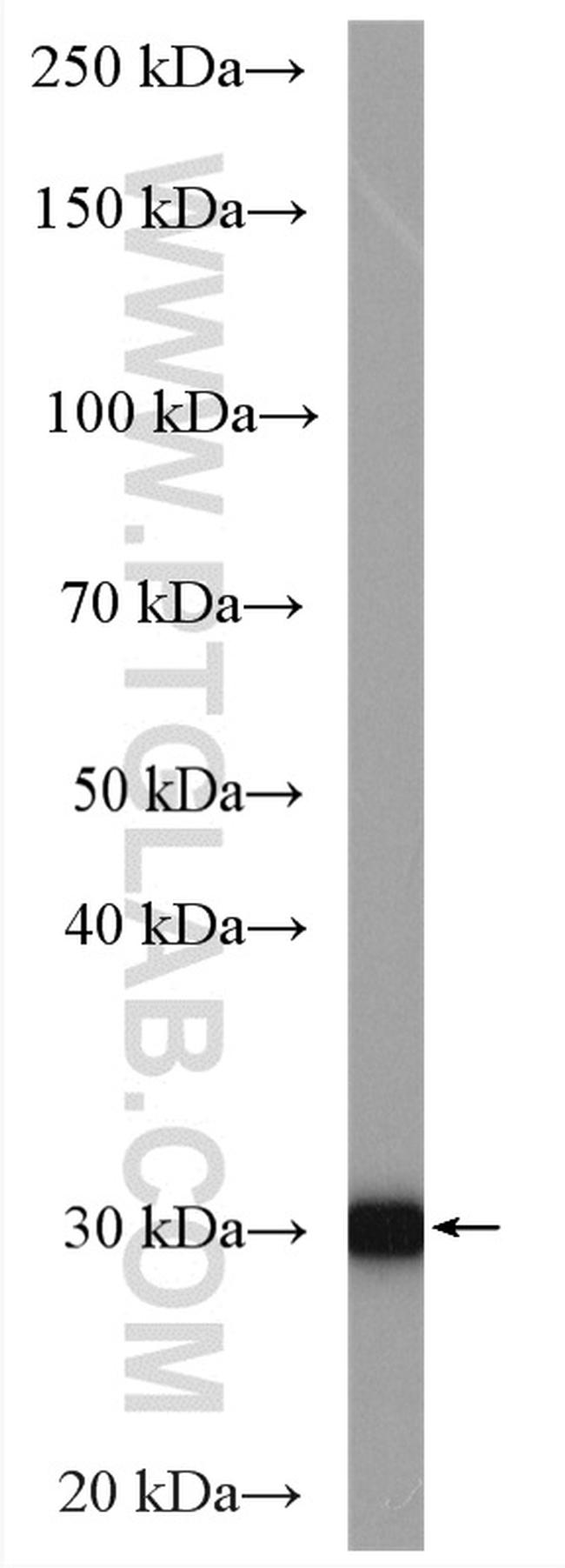 CA2 Antibody in Western Blot (WB)