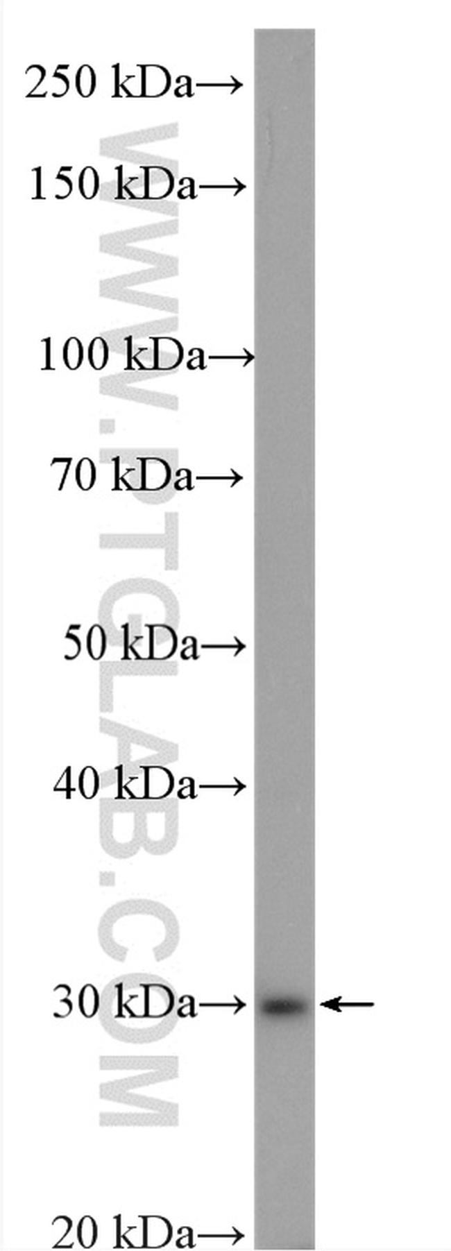 CA2 Antibody in Western Blot (WB)