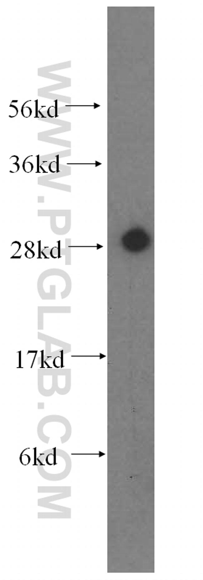 CA2 Antibody in Western Blot (WB)