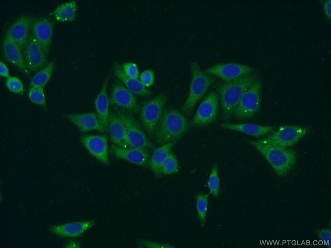 RPS5 Antibody in Immunocytochemistry (ICC/IF)