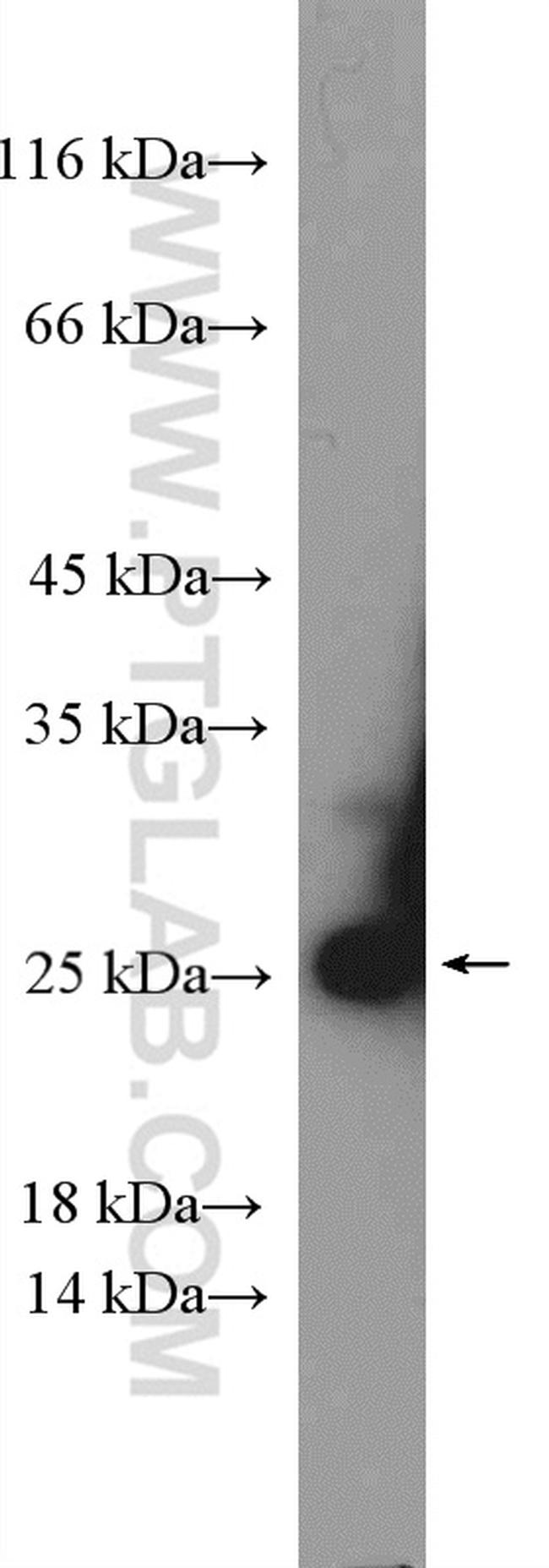 RPS5 Antibody in Western Blot (WB)