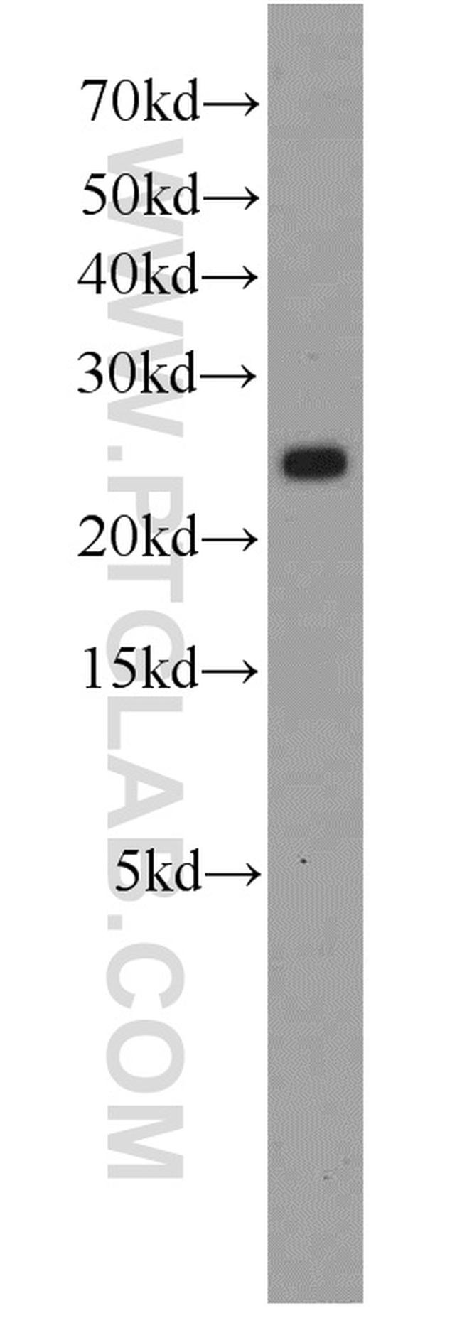 RPS5 Antibody in Western Blot (WB)