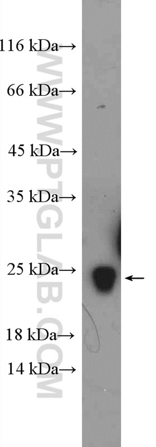 RPS5 Antibody in Western Blot (WB)