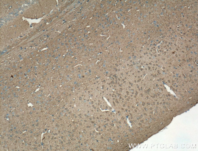 GAP43 Antibody in Immunohistochemistry (Paraffin) (IHC (P))