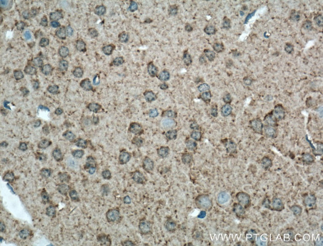 GAP43 Antibody in Immunohistochemistry (Paraffin) (IHC (P))