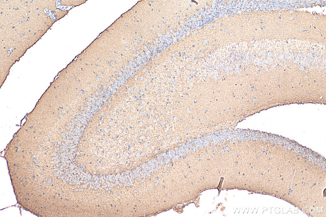 GAP43 Antibody in Immunohistochemistry (Paraffin) (IHC (P))