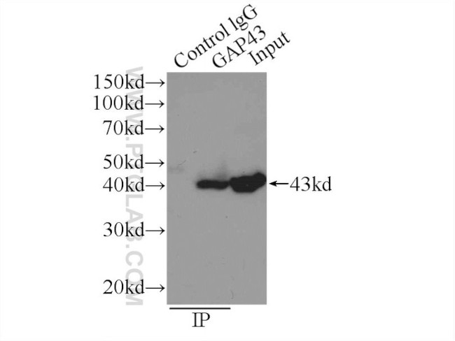 GAP43 Antibody in Immunoprecipitation (IP)